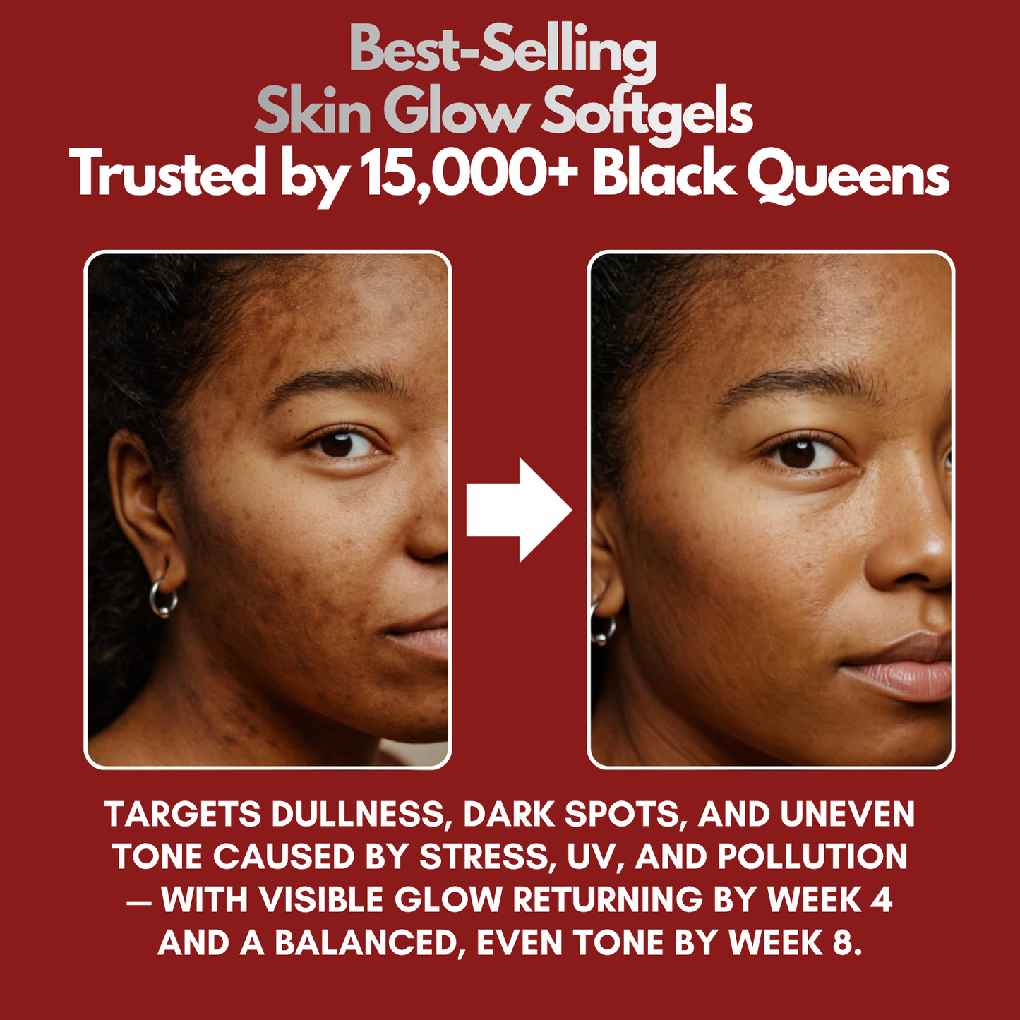 Lumora Skin Glow Softgels